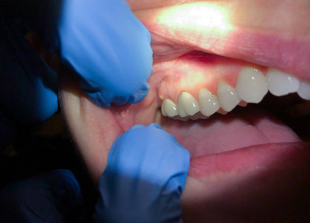 Best Emergency Treatment for Toothache in Black Rock, NM